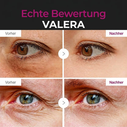 Calcium-Augenauflagen gegen Falten